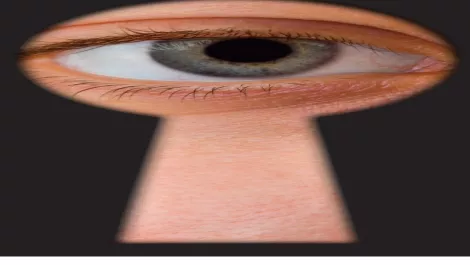 Eye